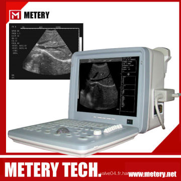 Scanner ultra-son numérique à ultrasons numériques